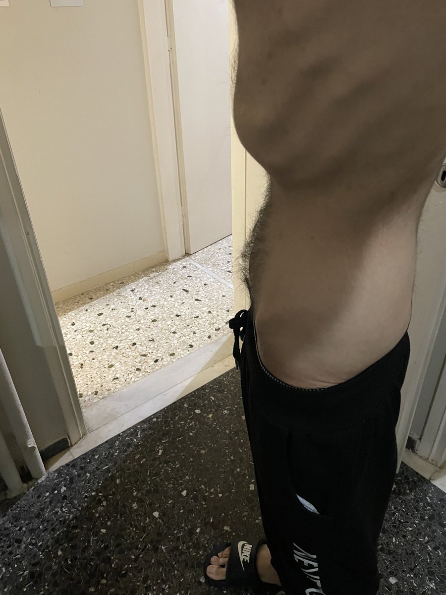 I beg you don’t ignore us .We are hungry,chronically ill. I have extreme mental health,my disabled brother has asthma,malnutrition, anemia &amp; other health issues I beg you support us 239€/450€ for food, meds,hygiene,electricity ko-fi.com/davidsting. paypal.com/paypalme/david…