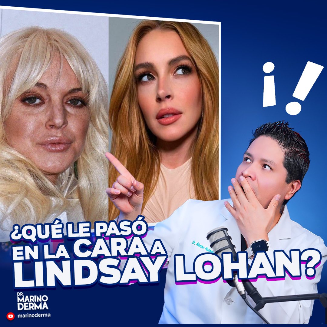 marinoderma's tweet image. 🌟¿QUÉ SE HIZO EN LA CARA LINDSAY LOHAN?🌟

🤩¡No te pierdas este domingo 07:15 pm el nuevo video! 🎥Por nuestro canal de YT marinoderma.

👉Comenta y comparte.

📲Dale clic:
youtu.be/o_Dhl66Btro

#dermatologo #LINDSAYLOHAN #piel #envejecimiento #arrugas