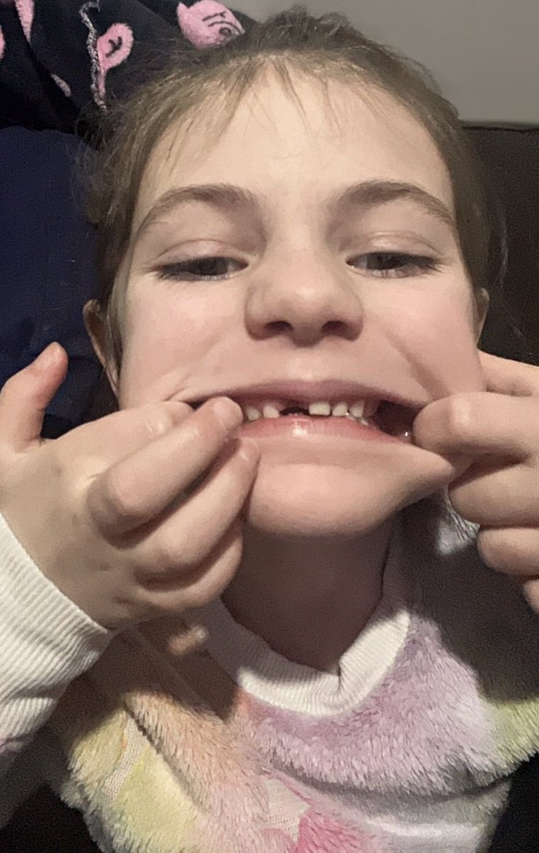 Tooth fairy is coming tonight!! 🥰