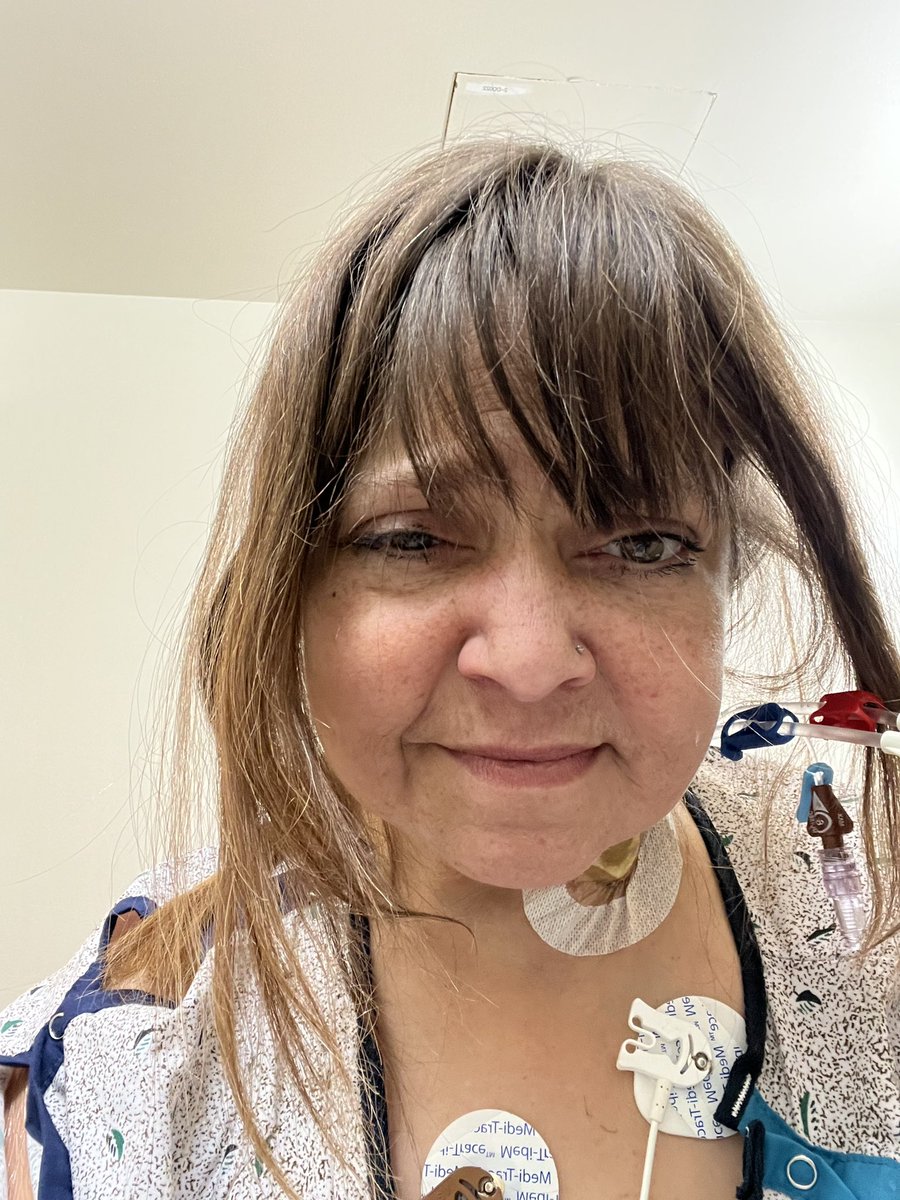 LoriAnnBerti3's tweet photo. #JohnnyDepp #JohnnyDeppIsALegend #DeppRelatives #crossboneskully Transplant #CKD #Diabetes #CHF Started dialysis yesterday and I’m still listening to these HV and Johnny Depp’s music. It keeps me positive. https://t.co/My2wgHIhWF