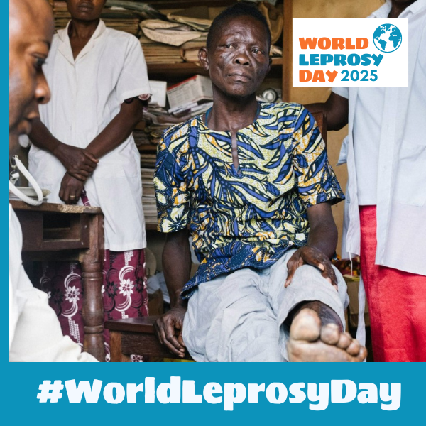 Act now to eliminate leprosy! Early detection &amp; prompt treatment are key to preventing disabilities &amp; halting transmission. Leprosy is curable, but timely action is crucial. Learn the signs, spread awareness, and support those affected. #WorldLeprosyDay #ActNow #UniteActEliminate