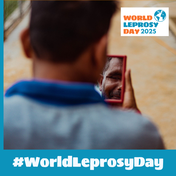 For 3-4 million people living with visible impairments due to leprosy, self-care 🩹 is crucial. Through self-care, we can stop visible impairments to 🦶👁️ 👐 before they start.
#WorldLeprosyDay #UniteActEliminateLeprosy #ActNow