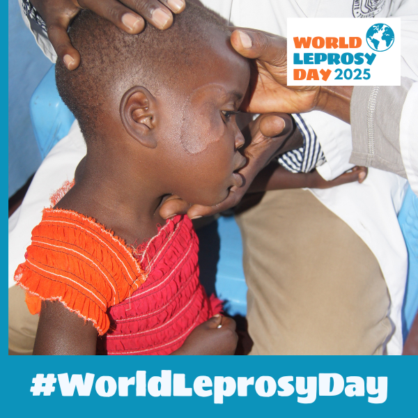 In the past 15 years the number of new child cases of leprosy – an indicator of ongoing transmission in a community – has halved. This downward trend needs to accelerate. #WorldLeprosyDay #UniteActEliminateLeprosy #ActNow