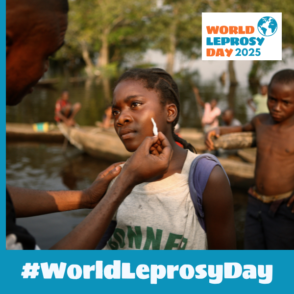 Leprosy is one of three neglected tropical diseases (NTDs) targeted by WHO for elimination (defined in leprosy as interruption of disease transmission) by 2030. It’s a challenging target but we can get there with political commitment and collaboration. #WorldLeprosyDay #ActNow
