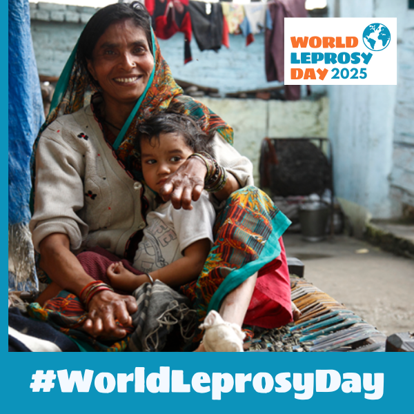 141 laws and regulations that discriminate against persons affected by leprosy have been catalogued in 26 countries. All such laws and regulations should be repealed or amended without delay. #WorldLeprosyDay #ActNow #EndStigma #ZeroDiscrimination #UniteActEliminateLeprosy