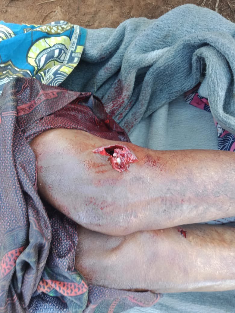 Aiglekivu003PKM's tweet photo. https://t.co/9RM8kYEL1g
🚨😭🚨Emergency Alert: #OngoingGenocide in #Minembwe🚨😭🚨
🚨This is an urgent plea to the #international community and those dismissing the ongoing genocide against the #Banyamulenge in #Minembwe. On Sunday, January 19, 2025, #FARDC forces, in coalition with Mai-Mai militias, FDLR, and Burundian armies, launched a #brutal attack on #Banyamulenge villages, indiscriminately targeting #children, #women, and #men. Despite prior warnings, no intervention was made.
🚨#international bodies, {@UNOSAPG } and #human rights groups {@hrw } must act immediately. Since 2017, the people of #Minembwe have faced relentless #massacres, with no support from the #government or #global community. Their survival is solely due to God’s grace and self-defense.
🚨#Immediate action is necessary to prevent further atrocities, as it may be a miracle if the people of #Minembwe witness another sunrise on January 20, 2025, Even though many of them are injured, killed, or hiding in fear in the bushes, as described here...
@hrw @UNHumanRights @UN_BintouKeita
Time is critical—intervene now.@UNSOS_ @WairimuANderitu @USEmbKinshasa @AsstSecStateAF @Adamchalwe @savecongotutsi @VPMDefenseRdc @kweziFaustin1 @PatriceNgira @i_Birere @jbserugo @MeKatembo @PatrickMuyaya @mkainerugabba @PaulKagame @UrugwiroVillage @jumuiya @WilliamsRuto @KagutaMuseveni @MoiseNyarugabo @SudkivuGouv @Gu79657Gustave @Rumenge1 @Rutshuru25
