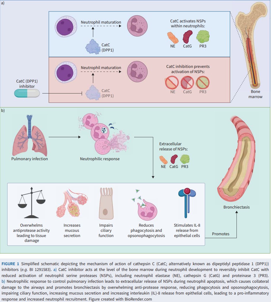 #Bronchiectasis is characterized by neutrophilic airway inflammation. However, therapeutics that can safely target #neutrophils have been elusive, until now. This brilliant editorial explains why CatC inhibition improves health outcomes in #bronchiectasis
bit.ly/3XmKrVQ