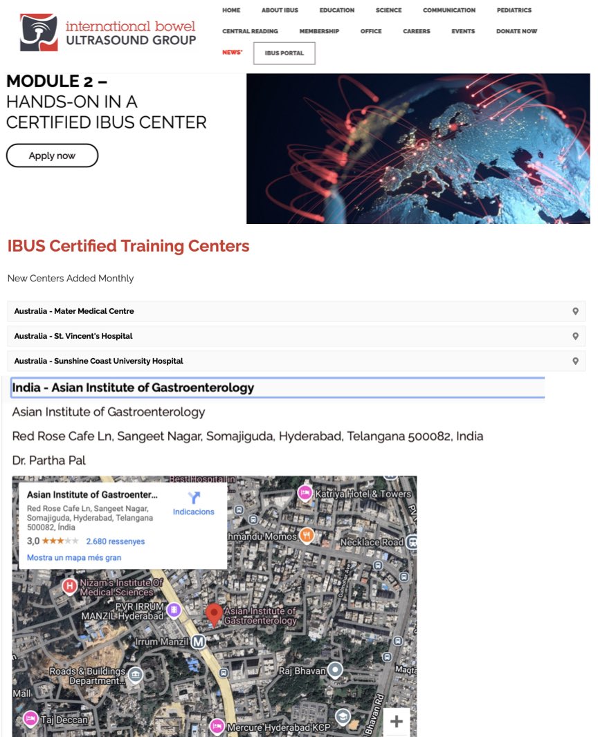Partha Pal (@ibd_pal) on Twitter photo Happy to share that we @Asian Institute of Gastroenterology have become a IBUS certified module 2 training centre .. encouraging everyone interested to apply to have a high volume experience <a href="/BowelUltrasound/">InternationalBowelUS</a> #IUS #🇮🇳 ibus-group.org/module-2/ Happy to share that we @Asian Institute of Gastroenterology have become a IBUS certified module 2 training centre .. encouraging everyone interested to apply to have a high volume experience <a href="/BowelUltrasound/">InternationalBowelUS</a> #IUS #🇮🇳 ibus-group.org/module-2/