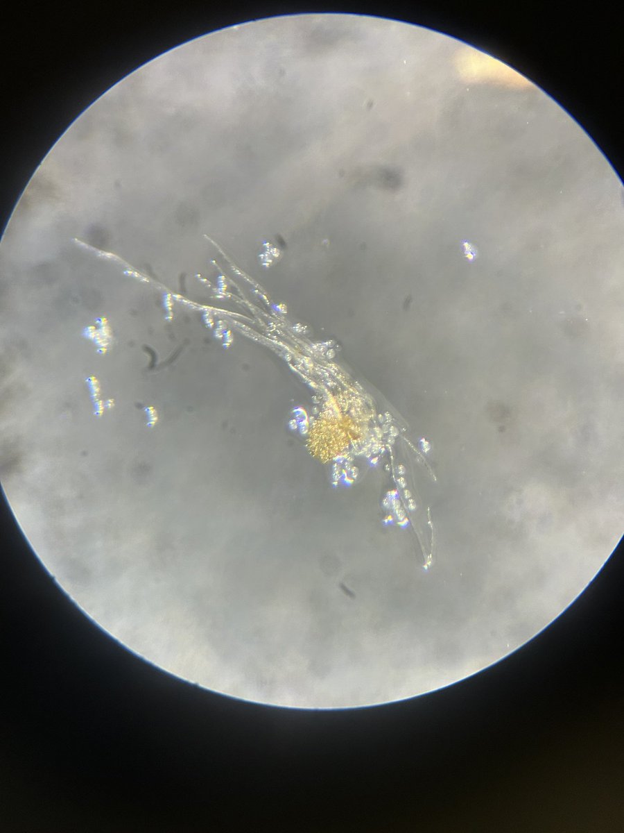 梨貯蔵花粉発芽率検査2】梨の花粉(冷凍貯蔵)の発芽率の検査。実体