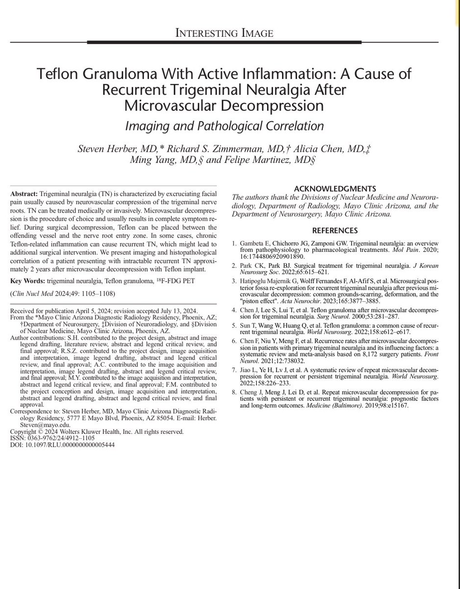 Bernard Bendok, MD (@bernardbendokmd) on Twitter photo Just published: Dr Richard Zimmerman and his colleagues have done some remarkable work on the relationship between teflon granuloma related inflammation and recurrence of trigeminal neuralgia with clinical, pathological and imaging findings.
<a href="/MayoClinic/">Mayo Clinic</a> <a href="/cvsection/">CV Section</a> Just published: Dr Richard Zimmerman and his colleagues have done some remarkable work on the relationship between teflon granuloma related inflammation and recurrence of trigeminal neuralgia with clinical, pathological and imaging findings.
<a href="/MayoClinic/">Mayo Clinic</a> <a href="/cvsection/">CV Section</a>