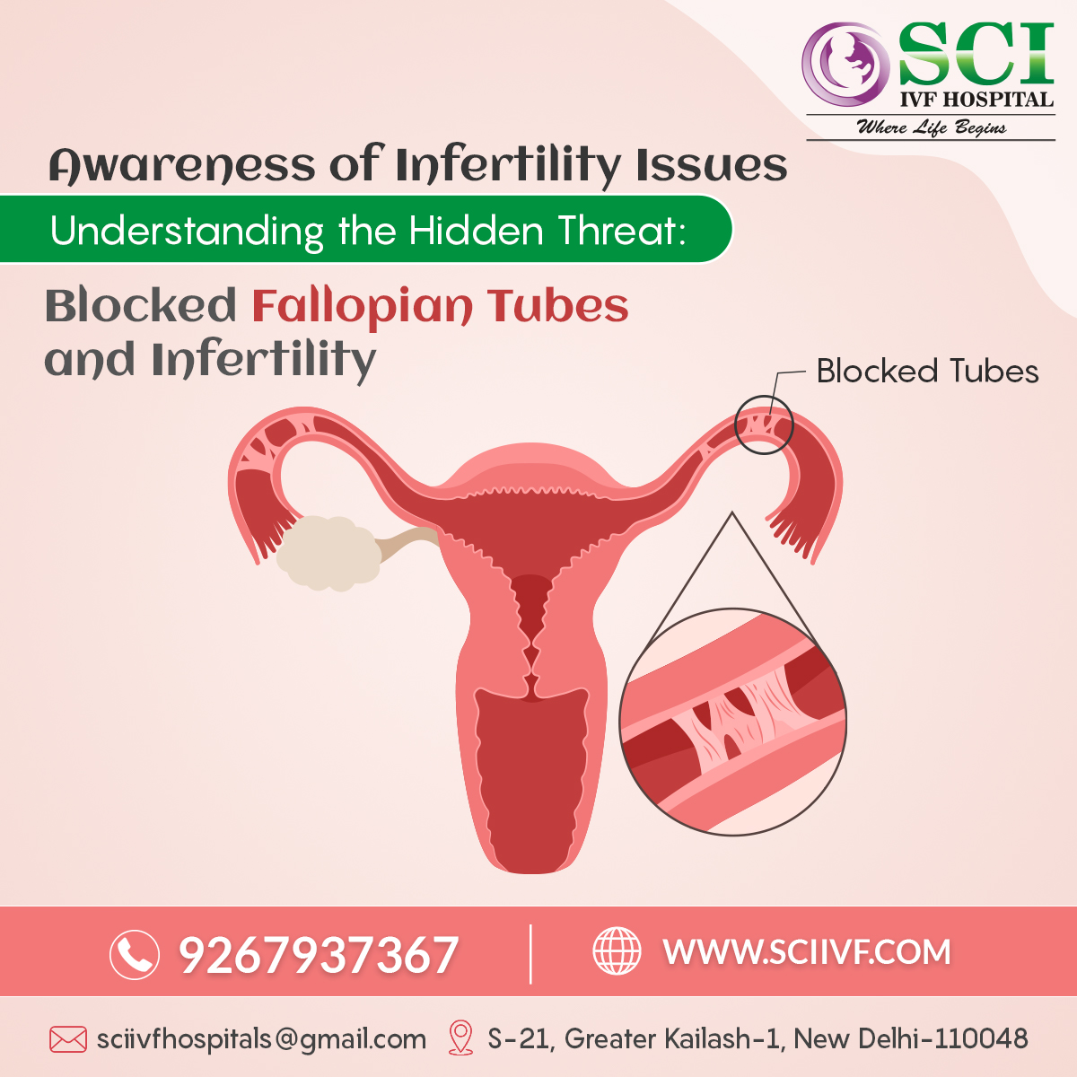 sciivf's tweet photo. Blocked fallopian tubes can silently impact your fertility journey. Early diagnosis and treatment are key to restoring hope. 💕

Call now for expert advice! +91-9267937367

#Fertility #InfertilityAwareness #FertilityJourney #BlockedFallopianTubes #HopeForParenthood https://t.co/DtOpycKvBH