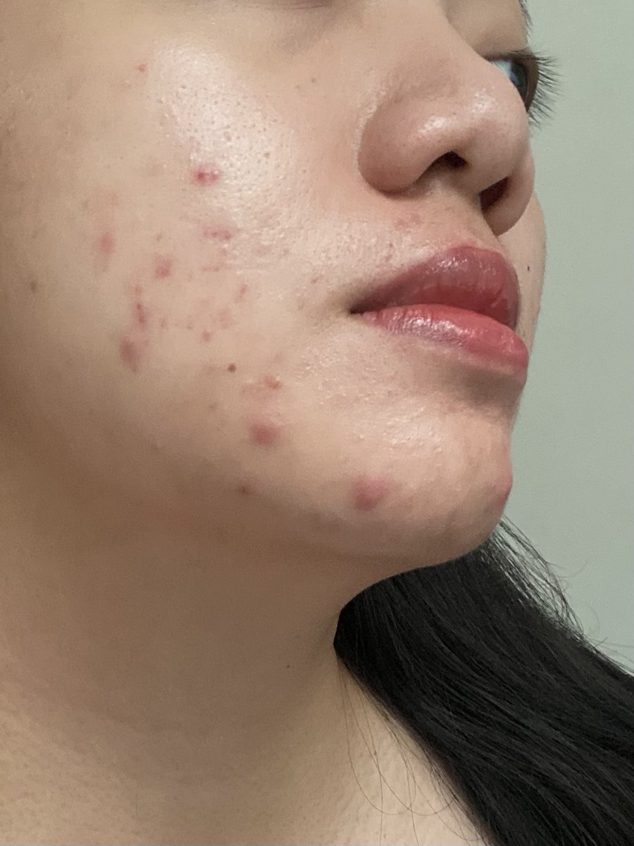 itsmybase's tweet photo. Kulit wajah tidak bercerita, tapi langsung merong-merong kalo kita salah…

Bahkan kita juga bingung salah nya di bagian apa 🥲 setuju ngga?

#ItsMyBASE #SkincareRoutine https://t.co/fcVis98KIT