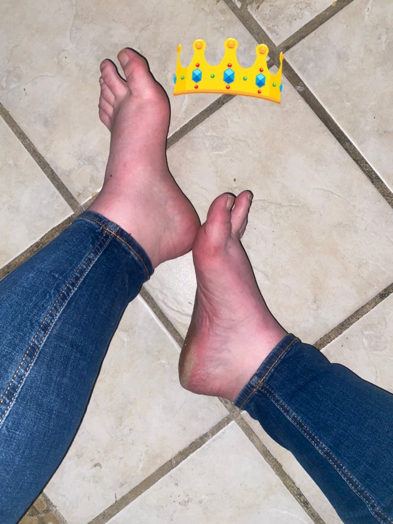 Who loves these pretty feet in jeans? 

Findom finsub femdom walletdrain whalesub cashcow paypig piggy humanAtm humiliation foot feet footfetish blackmail homewreck forcedbi Goddess ABDL sissy