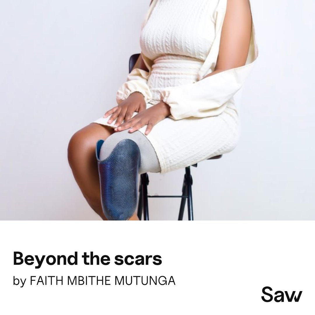 As I walk around with my prosthesis, I often notice people staring, their eyes filled with a mix of curiosity and pity. Many assume I was involved in a horrific road traffic accident, and I don't blame them.
savv.app/read/article/4…