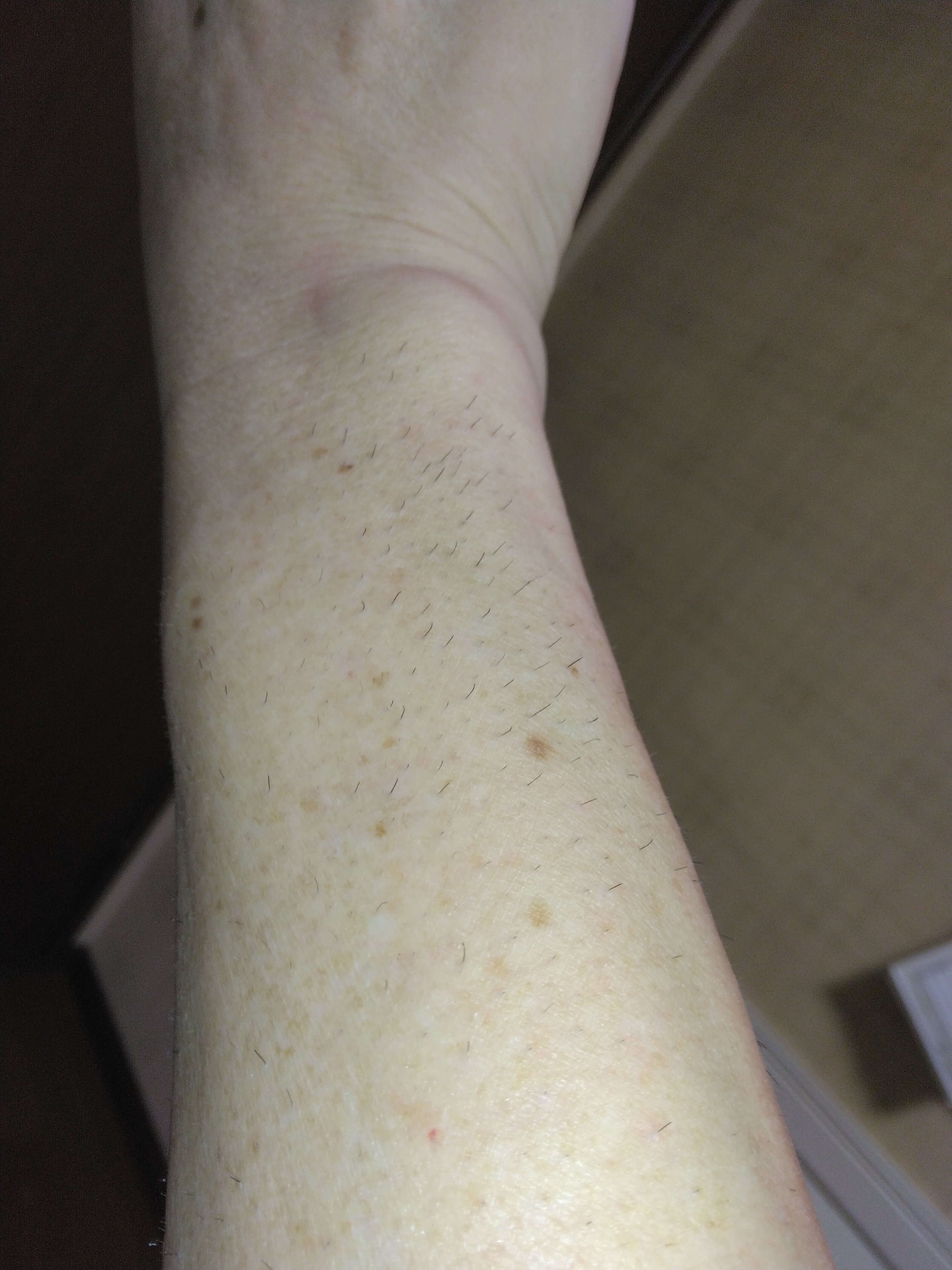 ケノン　【お値下げ更新中！】 ケノン公式 よくある質問