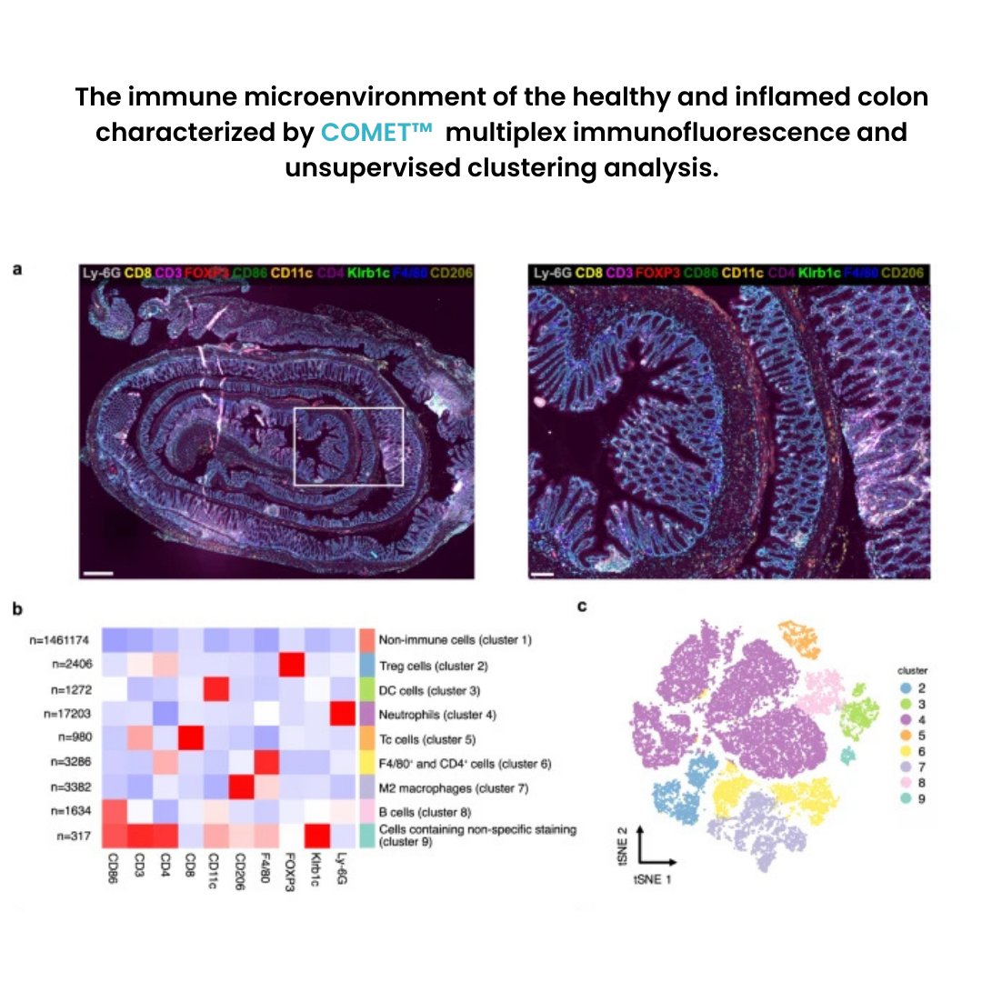Lunaphore (a Bio-Techne brand) (@lunaphore) on Twitter photo Leveraging the COMET™ platform, a new mouse study by Dr. Charlotte Stadler's group at <a href="/scilifelab/">SciLifeLab</a> explored the complex immune landscape of the colon during colitis, highlighting the sex difference in spatial composition and organization of cells.
➡️link.lunaphore.com/ci6 Leveraging the COMET™ platform, a new mouse study by Dr. Charlotte Stadler's group at <a href="/scilifelab/">SciLifeLab</a> explored the complex immune landscape of the colon during colitis, highlighting the sex difference in spatial composition and organization of cells.
➡️link.lunaphore.com/ci6