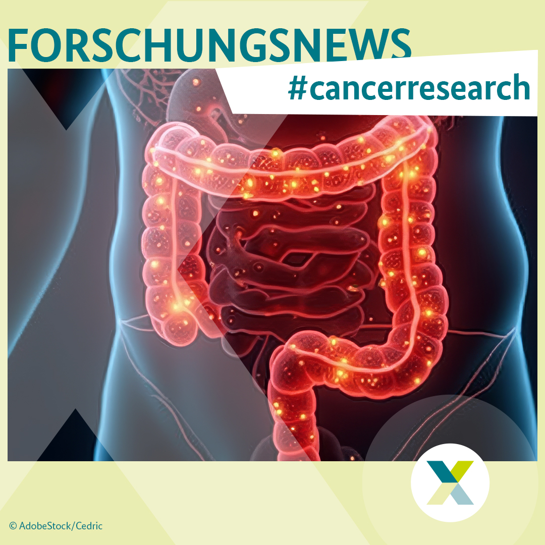 Mit innovativen Technologien der #Krebsentstehung auf der Spur🧬🌍 
Ein internationales Team untersucht mit 3D-Organoiden und CRISPR/Cas, wie #Tumorzellklone Barrieren überwinden.
Das soll neue Ansätze für #Prävention &amp; #Therapie eröffnen: bit.ly/40J6YOv
#XgegenKrebs