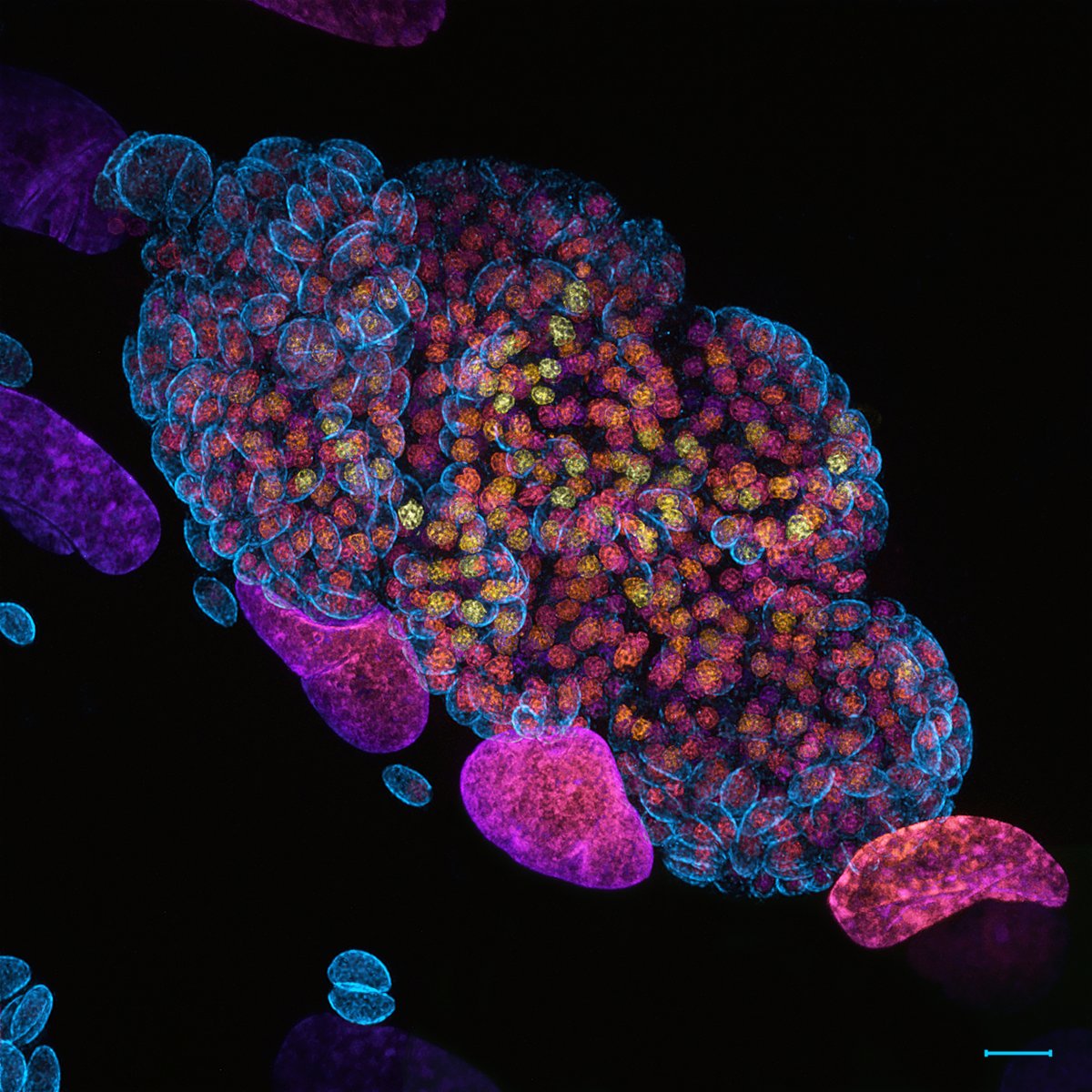 Ksena Bondarenko (@keskeseno) on Twitter photo Just won a Huygens Image Contest award from <a href="/svi_huygens/">SVI Huygens</a> with a #Toxoplasma-filled vacuole in fibroblasts :D
🟦 #Parasites
🟨🟧🟥🟪 depth-coloured nuclei (#DNA) of all cells present (deeper-darker)
Microscope: <a href="/zeiss_micro/">ZEISS Microscopy</a> LSM980
Scale: 5 μm
#Microscopy #FluorescenceMonday Just won a Huygens Image Contest award from <a href="/svi_huygens/">SVI Huygens</a> with a #Toxoplasma-filled vacuole in fibroblasts :D
🟦 #Parasites
🟨🟧🟥🟪 depth-coloured nuclei (#DNA) of all cells present (deeper-darker)
Microscope: <a href="/zeiss_micro/">ZEISS Microscopy</a> LSM980
Scale: 5 μm
#Microscopy #FluorescenceMonday