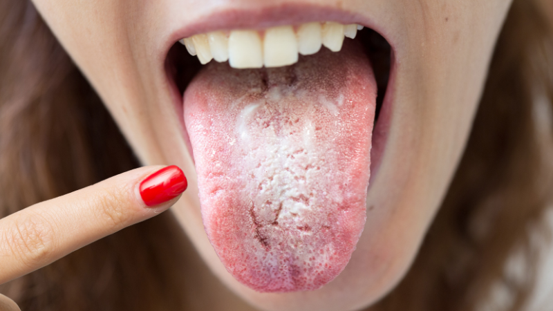 El 90% de las personas están deshidratadas.

Todo el mundo te dirá:

“Simplemente toma más agua”

Pero eso en realidad está destruyendo tu salud...

Aquí hay 8 claves fundamentales para una hidratación REAL (tu médico jamás te lo diría).

HILO.🧵