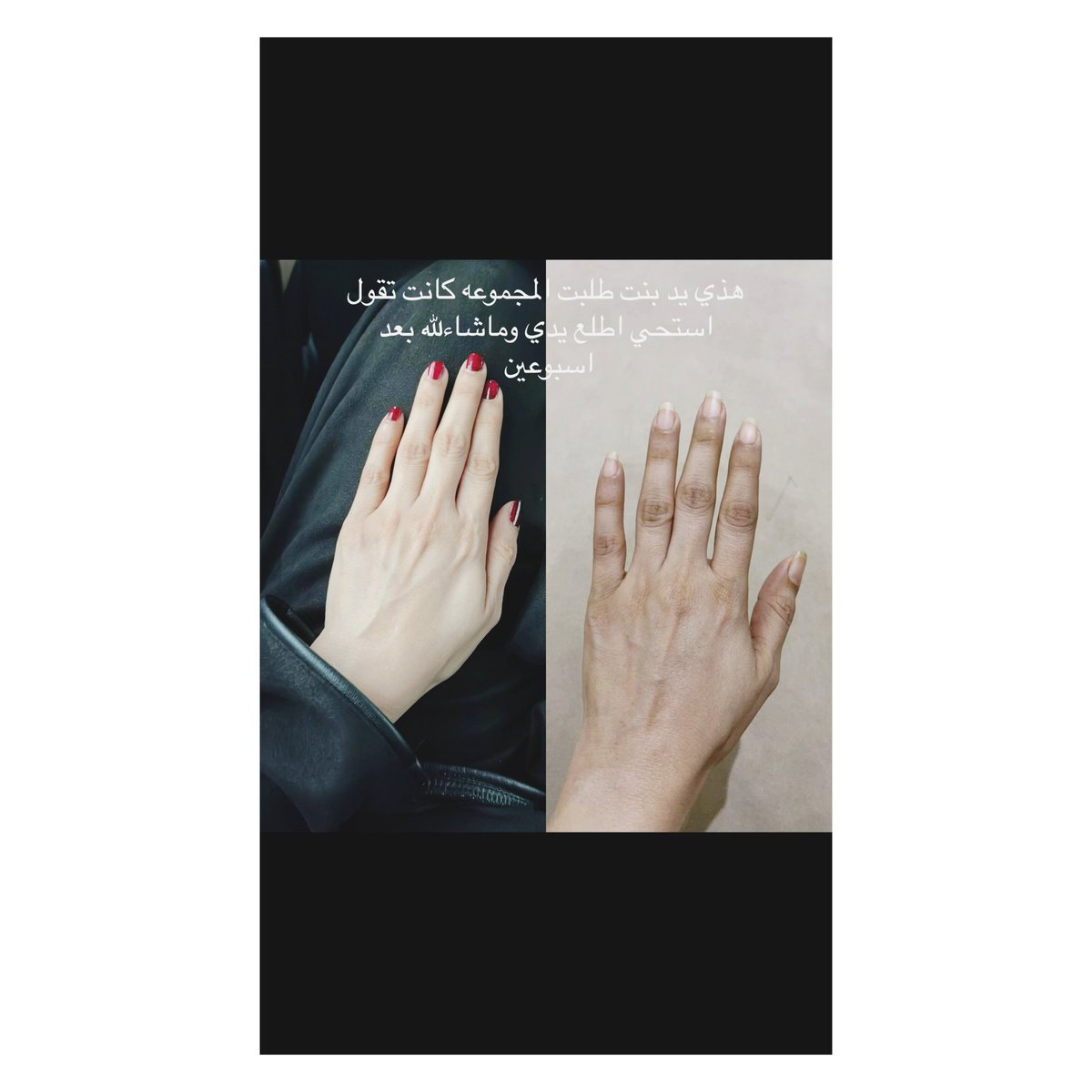 بدك يدك تصيري لق لق من البياض 💜🌸#اكسبلور#الامارات #اين_الصفقات_ياشركة_الاهلي #MARK #تفتيح #BreakingNews