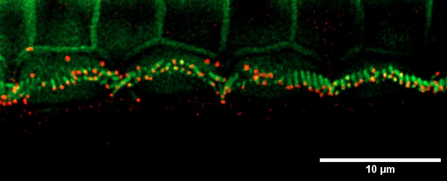 Happy #MicroscopyMonday everyone!📷 This image shows the inner hair cell stereocilia (green) with EPS8 (red) highlighting their tips. EPS8 is key in regulating stereocilia length and ensuring proper localization of other essential proteins.🧬🌟