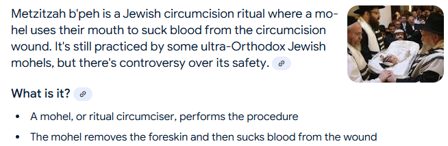 I rabbit holed into the Talmud last night and I'm really trying hard to understand how this text is acceptable and how some of these practices are still taking place.
 
As an example, metzitzah b'peh which is when a child is circumcised and the wound is then sucked on. This is