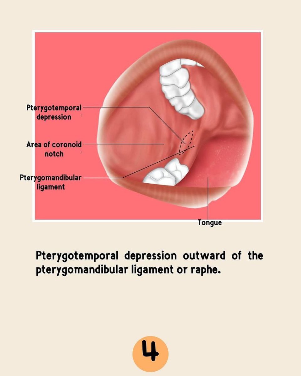 asnan_tbyb's tweet photo. Inferior alveolar Nerve block 

Great 👍 https://t.co/EJu4hIGTBg