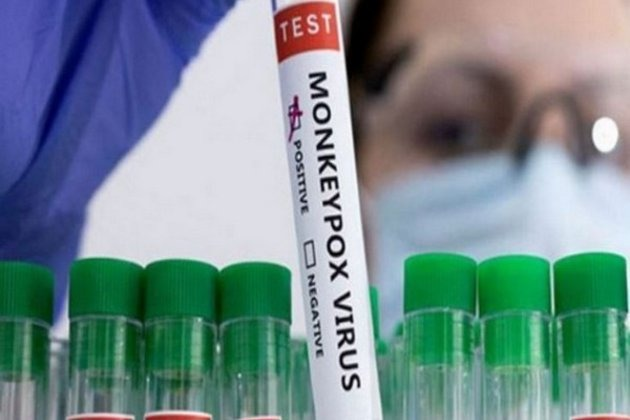 MarioNawfal's tweet photo. 🚨🇬🇧MPOX STRIKES AGAIN IN THE UK: PATIENT RUSHED TO HOSPITAL

Another case of mpox is making waves in East Sussex, marking the sixth confirmed case in England since October.

The new variant, Clade Ib, was identified in a patient recently back from Uganda, where community transmission is active.

The UK Health Security Agency is tracking close contacts and ensuring proper care to stop any potential spread. While the risk to the UK is low, vigilance remains key.blob:https://t.co/ltxknXyCoI

Source:  GB News