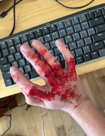 they were mean to vi again