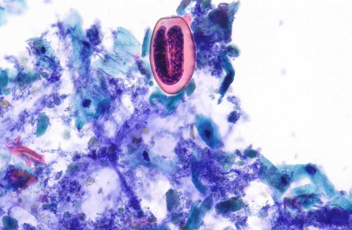 Bobbi Pritt, MD tweet media