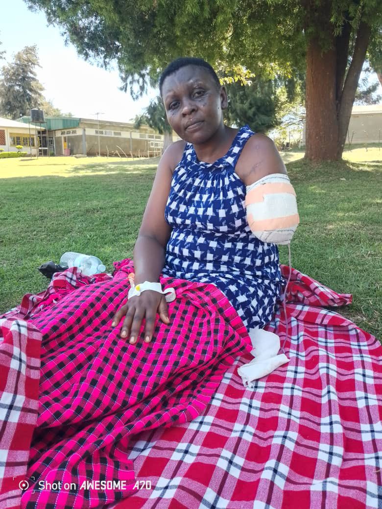 Mufra95's tweet photo. @URAuganda a friend got an accident and lost her hand on her way to do the URA aptitude test. 🥹🥹🥹 https://t.co/50A6N8tGzp