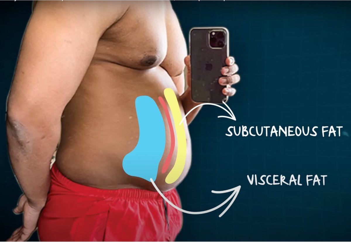 thoughtleadrfit's tweet photo. Here's the deadliest part about being overweight...

There's ONE silent killer that can cause:

• Cancer
• Diabetes
• Heart disease

Even SKINNY people can have it.

Here's how to destroy visceral fat before it destroys you: https://t.co/LDldNEq7df