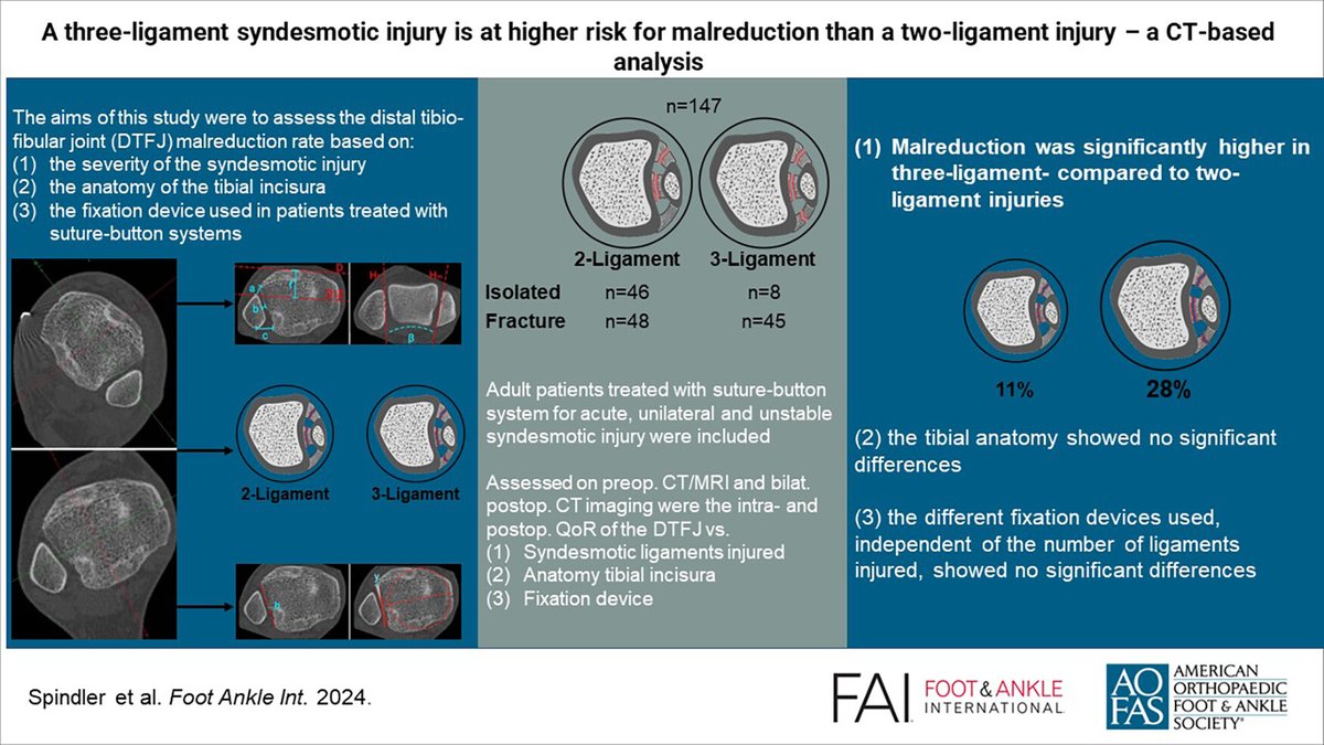 How does the number of syndesmotic ligaments injured, the tibial anatomy &amp; the use of either a single suture-button, a double suture-button or a suture-button system + syndesmotic screw influence the quality of reduction of the distal tibio-fibular joint? ow.ly/Aaj350Uy03O