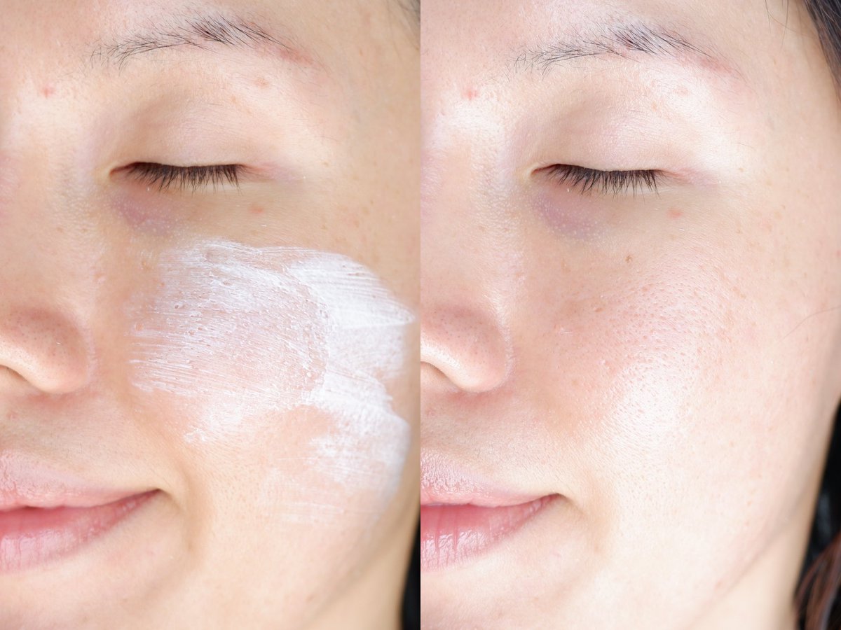 กันแดดสำหรับคนเป็นสิวของคูร่า-เอ็มดี ตัวนี้มีพรีไบโอติก ป้องกันรังสี UVA UVB ใช้แล้วเนื้อบางเบากว่าที่คิดมากๆ เห็นสีขาวเนื้อดูเข้มข้นแบบนี้ แต่จริงๆคือเนียนไปกับผิวเลย ไม่วอก เนื้อลื่นเกลี่ยง่าย ซึมลงผิวแล้วเย็นสบาย ไม่มีความเหนียวหน้าเลย แต่งหน้าต่อได้ไม่เป็นคราบ