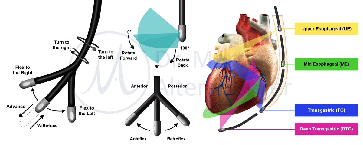 An imaging standard is crucial &amp; this holds true for transesophageal echocardiography 💖
We will continue with our first patient in the echolab, let‘s take the detour to see some graphics that illustrate a standard TEE study. More to come 😊 . #ultrasound #MedTwitter