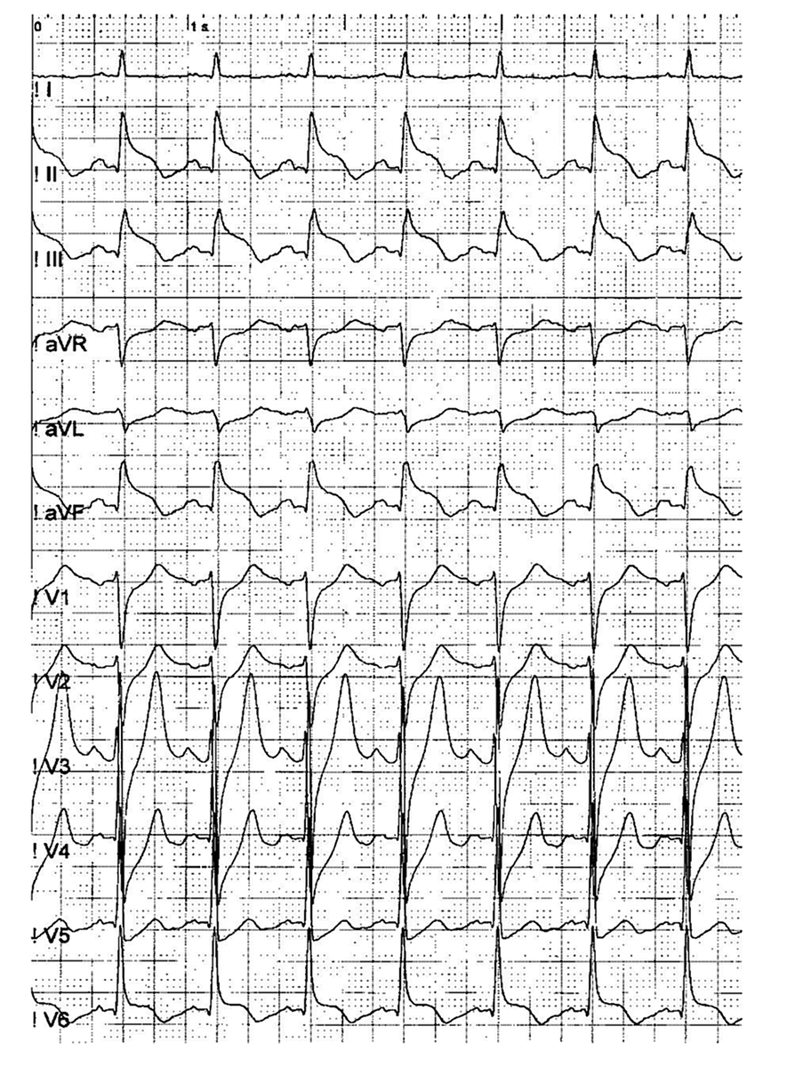 Chest pain; what`s wrong here?