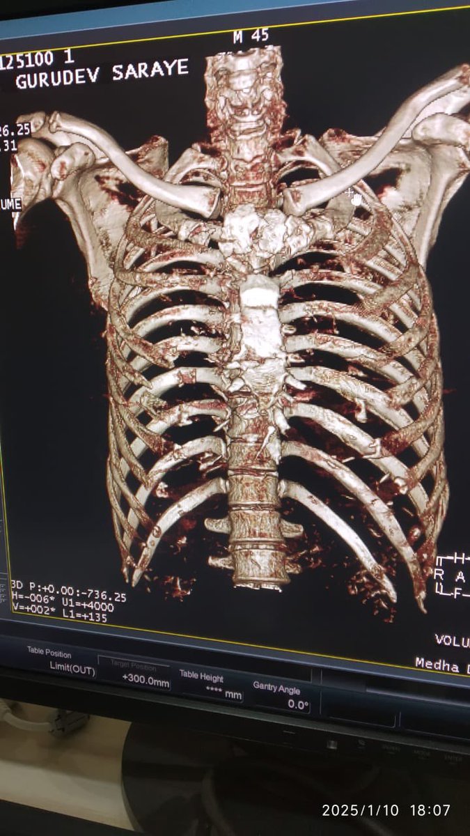 Dr Nitin Kimmatkar Orthopaedic Trauma specialist tweet media