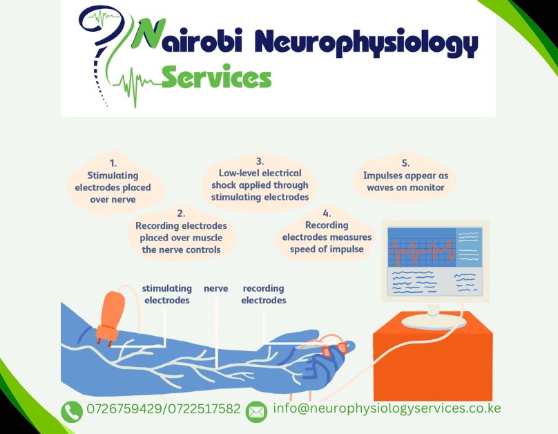 nrbneuro2017's tweet photo. Discover what to expect during a nerve conduction study with Nairobi Neurophysiology Services. #NerveConductionStudy #Neurophysiology #HealthcareInnovation https://t.co/kyIVxJryug