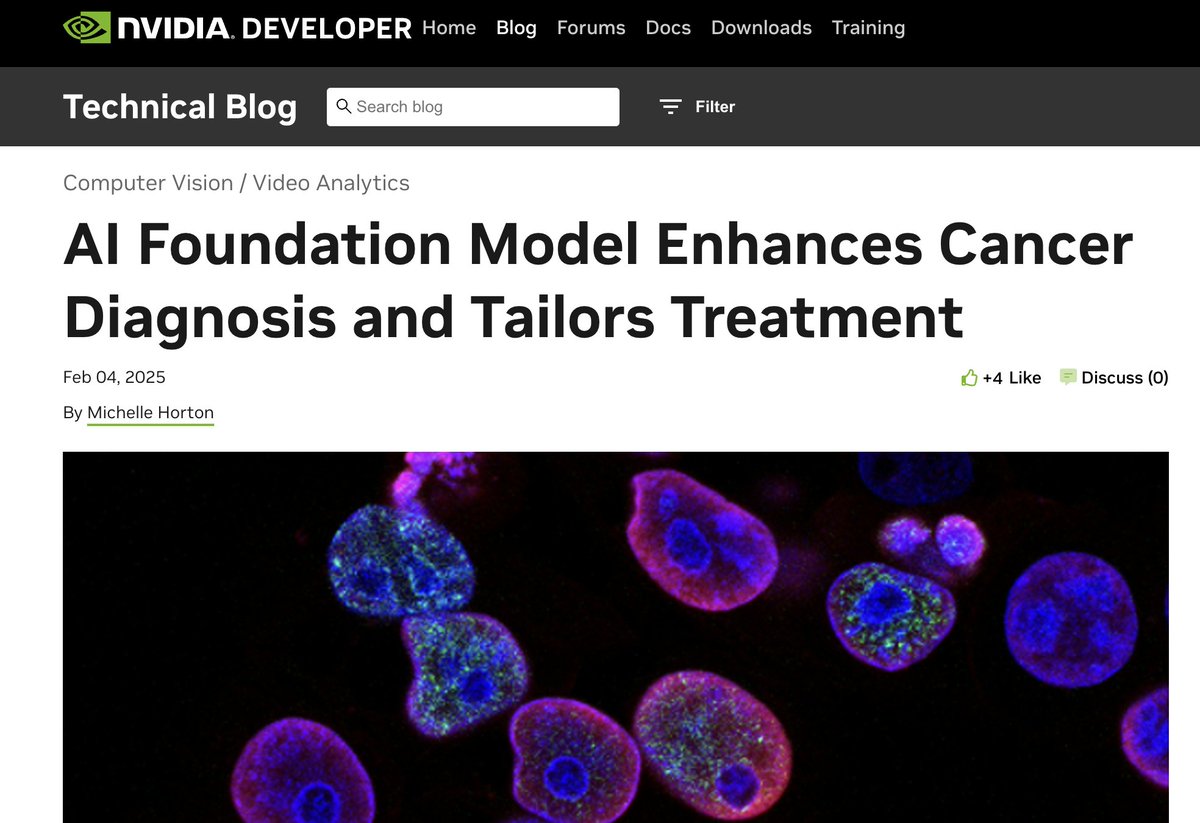 DerekHsiang's tweet photo. 🎗️ On WorldCancerDay, our study is highlighted by NVIDIA. May intelligent computing illuminate the path to a cancer-free world. https://t.co/gHu7YXqN6w ✨ #WorldCancerDay #AIinPrecisionOncology https://t.co/V2vLZS1D0q