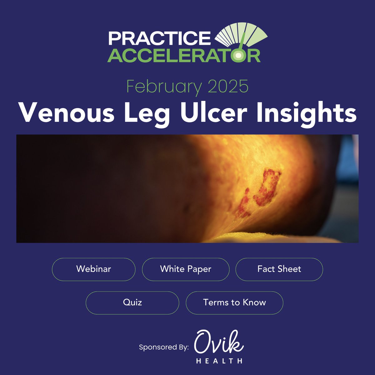 WoundSource's tweet image. The February 2025 Practice Accelerator is Live! 🔗 okt.to/AyUShH

This month, we’re focusing on Venous Leg Ulcer Insights!

🔹 Sponsored by @OvikHealth
#WoundCare #PracticeAccelerator #VenousLegUlcers #WoundHealing #HealthcareEducation #ChronicWounds