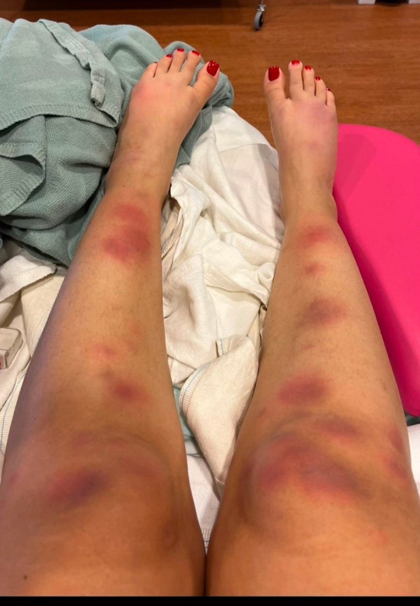 What is the diagnosis?