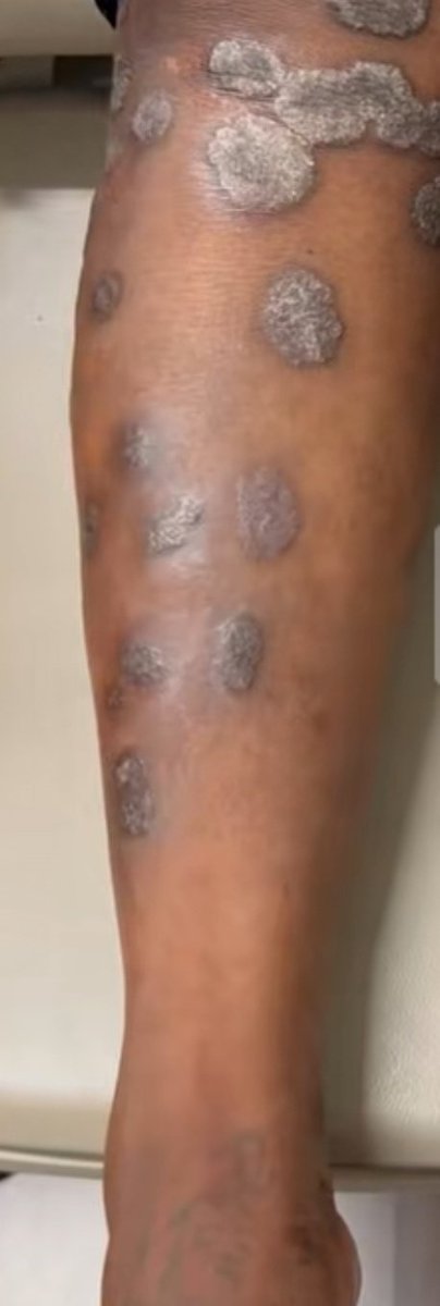 What is the diagnosis?