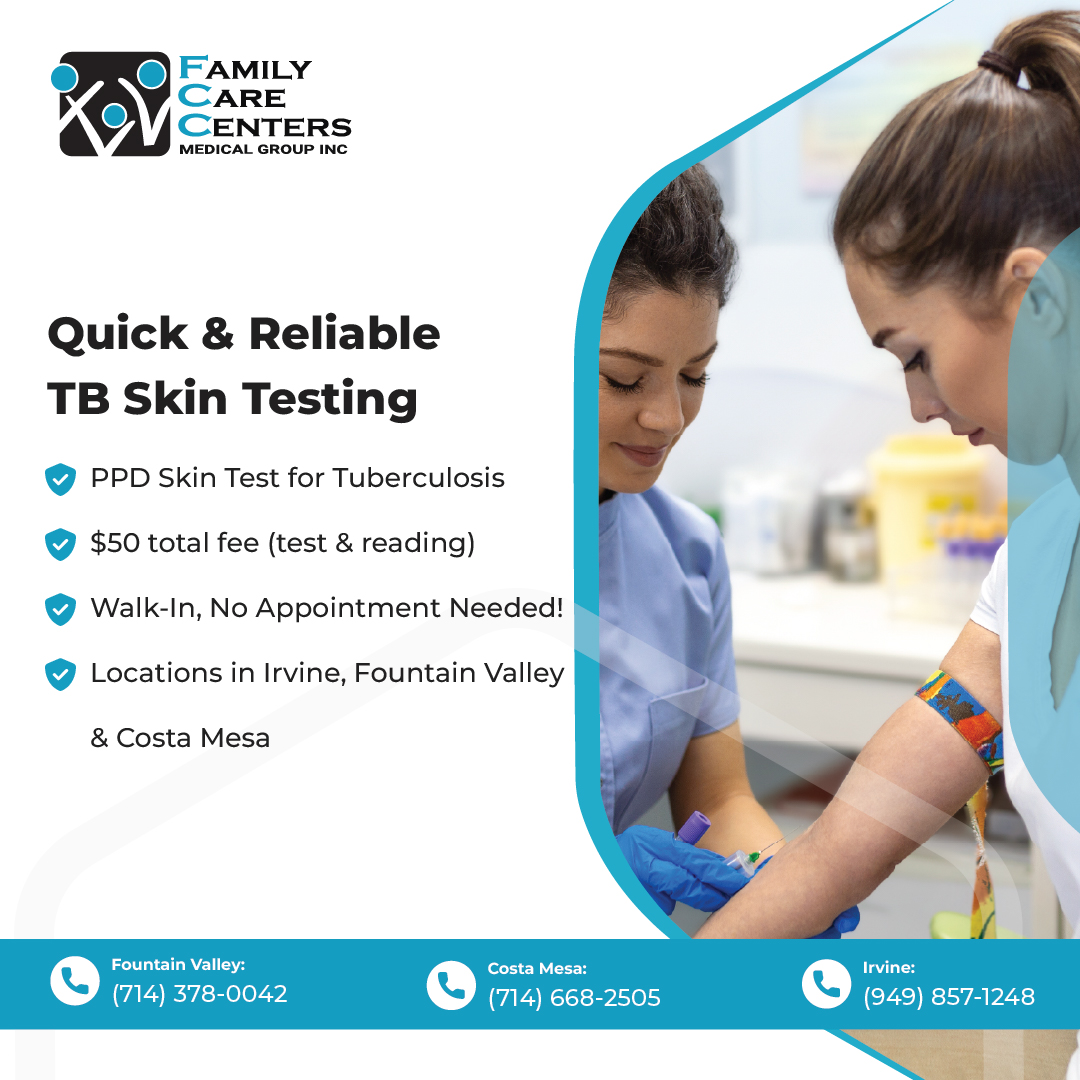 WBWalkIn's tweet photo. Quick &amp; affordable TB testing near you! Walk in today—$50 total for test &amp; reading. Open 7 days a week in Irvine, Fountain Valley, &amp; Costa Mesa. 

#TBSkinTest #WalkInClinic #PPDSkinTest #AffordableCare #StayHealthy #HealthAndWellness #QuickTesting #UrgentCare #FCCMG https://t.co/RfgKGOAh7o