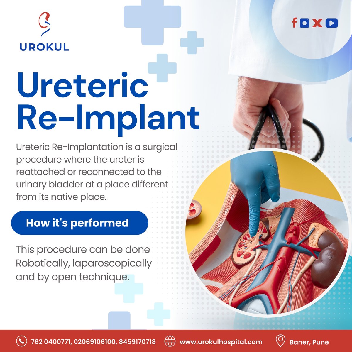 UrokulHospital's tweet photo. When backflow becomes a concern, ureteral reimplant is the solution. Keeping your kidneys safe, one step at a time.

#UrokulInstitute
#BanerPune
#KidneyCare
#UreteralReimplant
#BackflowPrevention
#HealthyKidneys
#KidneyProtection
#UrologySurgery https://t.co/ymqlXAuDqF