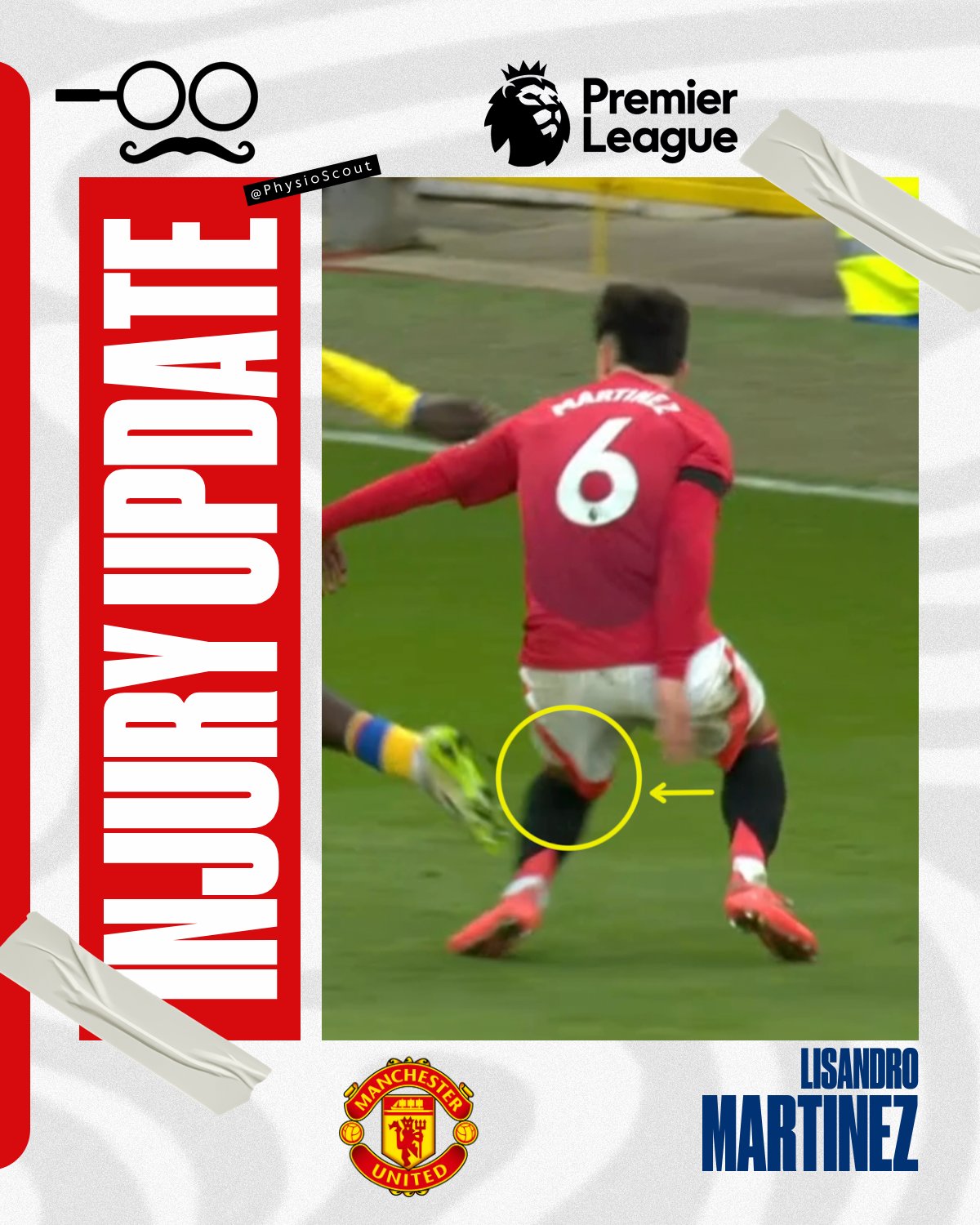 【ラプンツェル様用】LETHAL INJURY / Melancholia Man United dealt huge Lisandro Martinez blow as injury