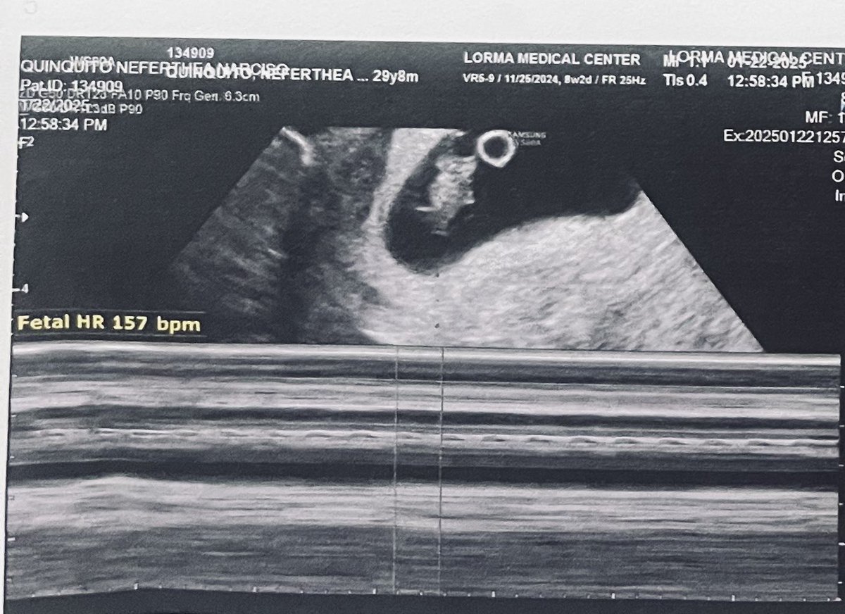 theaquinquito's tweet photo. From the very moment that I learned about you, all I have been praying is for you to be safe and that we’ll be able to be together soon 🥰 https://t.co/t6DXj9Fy2r