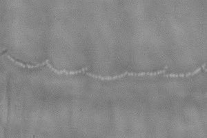 HearingShef's tweet image. Happy #MicroscopyMonday, everyone! Today we have a brightfield image of some inner hair cell stereocilia, courtesy of Sam 🔬.