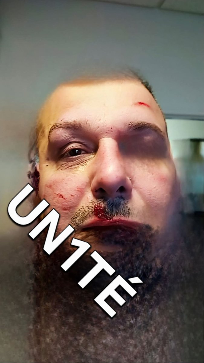 UN1TE_policenat's tweet image. Nouvelle agression d'un policier à #Chaumont

Un collègue a été violemment attaqué par un individu multirécidiviste, récemment arrivé sur le territoire. 

Nos collègues risquent leur vie pour protéger la population, ils ne doivent plus être pris pour cibles !

UN1TÉ apporte tout