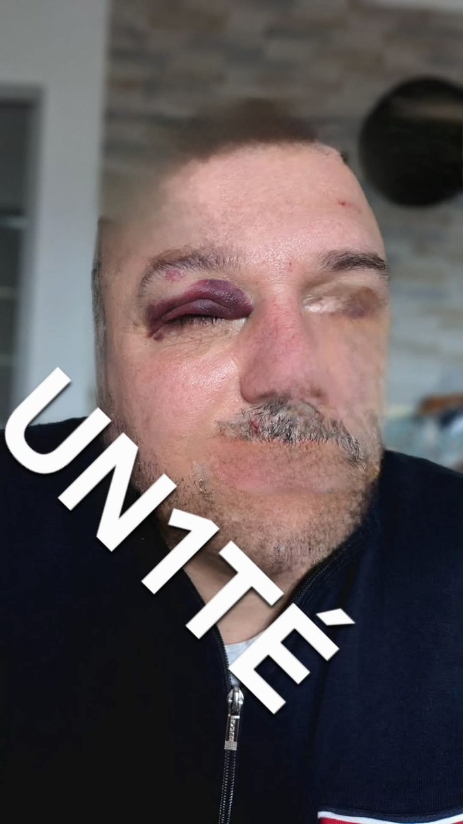 UN1TE_policenat's tweet image. Nouvelle agression d'un policier à #Chaumont

Un collègue a été violemment attaqué par un individu multirécidiviste, récemment arrivé sur le territoire. 

Nos collègues risquent leur vie pour protéger la population, ils ne doivent plus être pris pour cibles !

UN1TÉ apporte tout