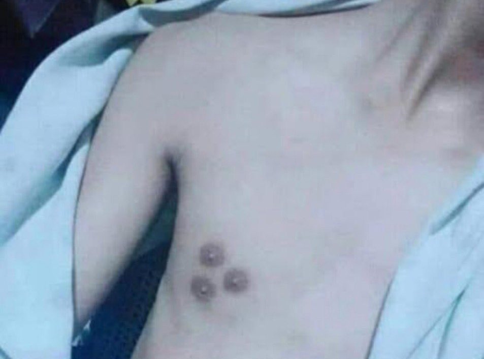 Si pee y estornuda a la vez, te hace captura de pantalla.